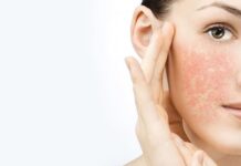 Что такое шелушение и почему это опасно для кожи? Что такое шелушение и почему это опасно для кожи?