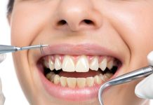 Профессиональная чистка зубов: забота о здоровье и красоте улыбки с настоящими специалистами